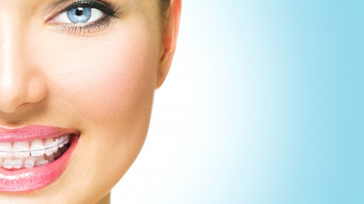 creating-smiles bigstock Braces Beautiful Woman smile